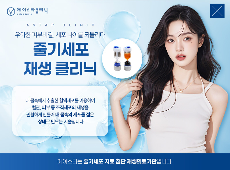 줄기세포