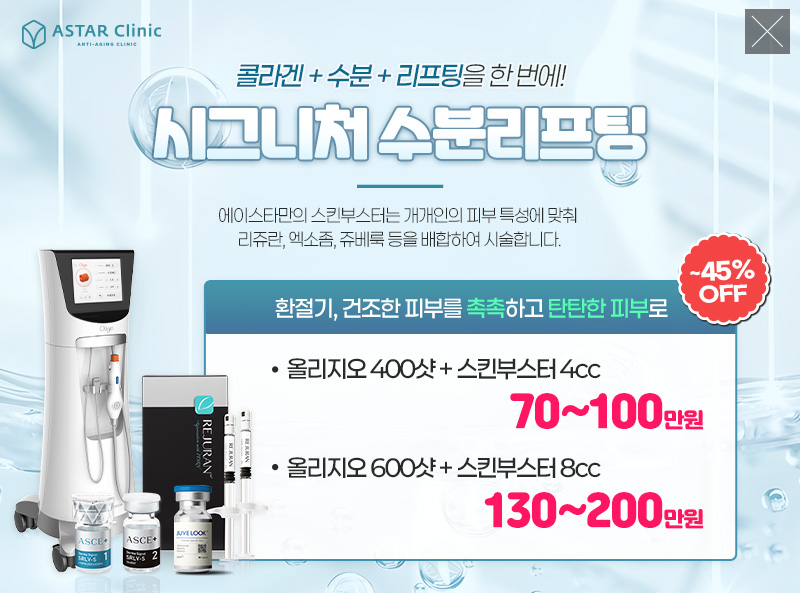 수분리프팅